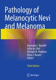 Cover von Pathology of Melanocytic Nevi and Melanoma