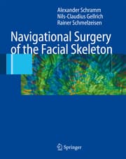 Cover von Navigational Surgery of the Facial Skeleton