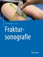 Cover von Fraktursonografie