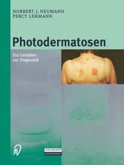 Cover von Photodermatosen