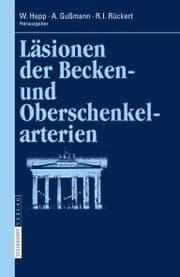 Cover von Läsionen der Becken- und Oberschenkelarterien