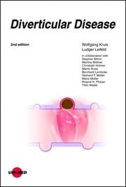 Cover von Diverticular Disease