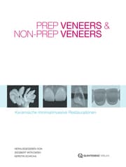 Cover von Prep Veneers und Non-Prep Veneers