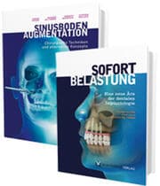 Cover von Sinusbodenaugmentation und Sofortbelastung