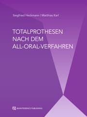 Cover von Totalprothesen nach dem All-Oral-Verfahren
