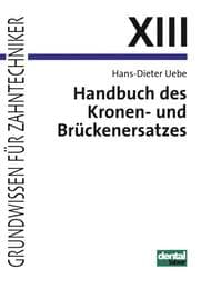 Cover von Handbuch des Kronen- und Brückenersatzes