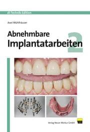 Cover von Abnehmbare Implantatarbeiten 2