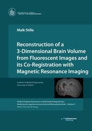 Cover von Reconstruction of a 3-Dimensional Brain Volume from Fluorescent Images and its Co-Registration with Magnetic Resonance Imaging