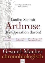 Cover von Laufen Sie mit Arthrose der Operation davon!