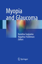 Cover von Myopia and Glaucoma