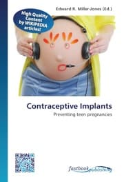 Cover von Contraceptive Implants