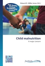 Cover von Child malnutrition