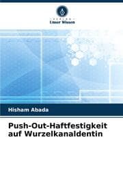 Cover von Push-Out-Haftfestigkeit auf Wurzelkanaldentin
