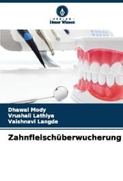 Cover von Zahnfleischüberwucherung