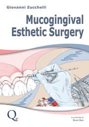 Cover von Mucogingival Esthetic Surgery
