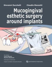 Cover von Mucogingival Esthetic Surgery around Implants