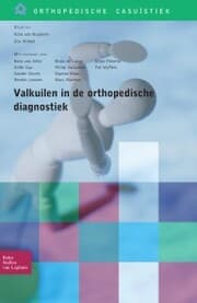 Cover von Valkuilen in de orthopedische diagnostiek