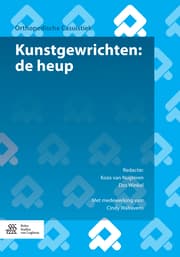 Cover von Kunstgewrichten: de heup