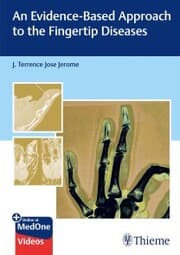 Cover von An Evidence-Based Approach to the Fingertip Diseases