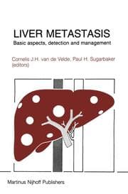 Cover von Liver Metastasis