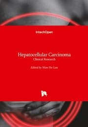 Cover von Hepatocellular Carcinoma