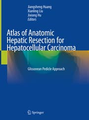 Cover von Atlas of Anatomic Hepatic Resection for Hepatocellular Carcinoma