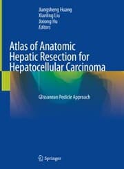 Cover von Atlas of Anatomic Hepatic Resection for Hepatocellular Carcinoma