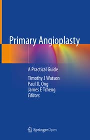 Cover von Primary Angioplasty