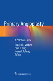 Cover von Primary Angioplasty