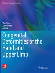 Cover von Congenital Deformities of the Hand and Upper Limb