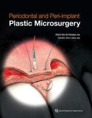Cover von Periodontal and Periimplant Plastic Microsurgery