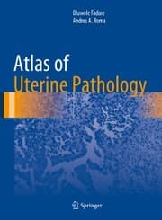 Cover von Atlas of Uterine Pathology