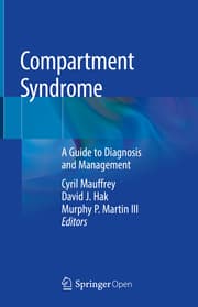 Cover von Compartment Syndrome