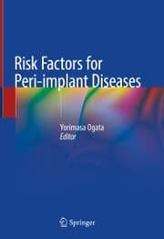 Cover von Risk Factors for Peri-implant Diseases