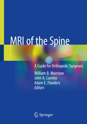 Cover von MRI of the Spine