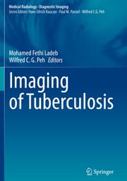 Cover von Imaging of Tuberculosis