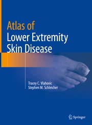 Cover von Atlas of Lower Extremity Skin Disease