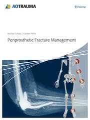 Cover von Periprosthetic Fracture Management