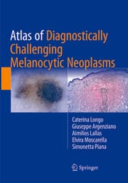 Cover von Atlas of Diagnostically Challenging Melanocytic Neoplasms