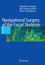Cover von Navigational Surgery of the Facial Skeleton