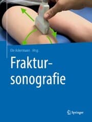 Cover von Fraktursonografie