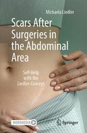 Cover von Scars After Surgeries in the Abdominal Area