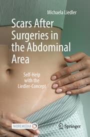 Cover von Scars After Surgeries in the Abdominal Area