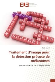 Cover von Traitement dimage pour la détection précoce de mélanomes