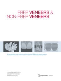 Cover von Prep Veneers und Non-Prep Veneers
