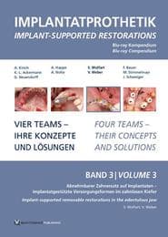 Cover von Implantatprothetik. Blu-Ray, Band 3