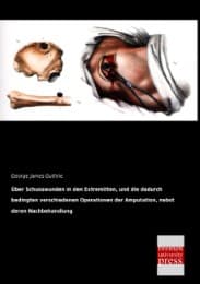 Cover von Über Schusswunden in den Extremitten, und die dadurch bedingten verschiedenen Operationen der Amputation, nebst deren Nachbehandlung