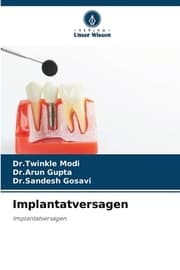 Cover von Implantatversagen