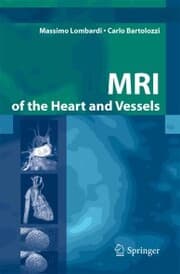 Cover von MRI of the Heart and Vessels