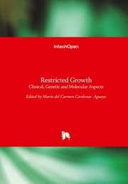 Cover von Restricted Growth